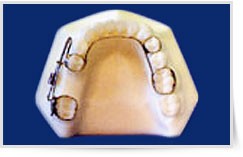 Mesial Jet